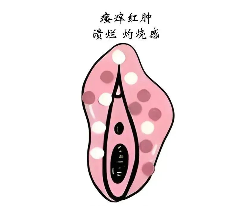 外阴白斑治疗时间周期是受哪些因素影响的？