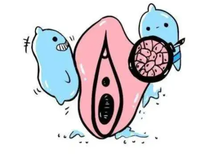 如何区分外阴白斑与阴道炎? 如何区分外阴白斑与阴道炎?